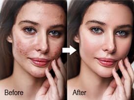 Image Retouching
